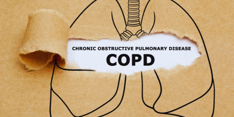 Exploring COPD Treatment Breakthroughs: What's New for Patients