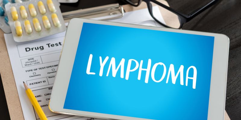 Lymphoma: Spotting the Early Signs and Understanding Treatment Options